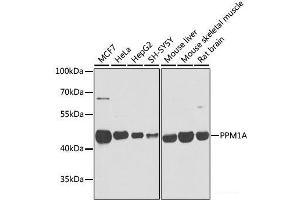 Western blot analysis of extracts of various cell lines using PPM1A Polyclonal Antibody at dilution of 1:1000. (PPM1A Antikörper)