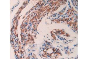 IHC-P analysis of Mouse Ovary Tissue, with DAB staining. (GAS6 Antikörper  (AA 483-646))