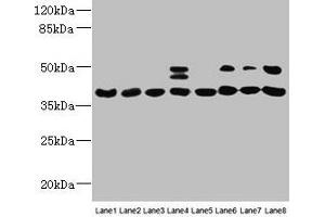 Western blot All lanes: HIF1AN antibody at 12 μg/mL Lane 1: Mouse heart tissue Lane 2: Mouse skeletal muscle tissue Lane 3: K562 whole cell lysate Lane 4: MCF-7 whole cell lysate Lane 5: HL60 whole cell lysate Lane 6: 293T whole cell lysate Lane 7: Jurkat whole cell lysate Lane 8: A375 whole cell lysate Secondary Goat polyclonal to rabbit IgG at 1/10000 dilution Predicted band size: 41 kDa Observed band size: 41, 48 kDa (HIF1AN Antikörper  (AA 2-254))