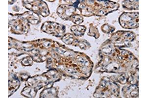The image on the left is immunohistochemistry of paraffin-embedded Human placenta tissue using ABIN7130075(LEPREL2 Antibody) at dilution 1/50, on the right is treated with fusion protein.