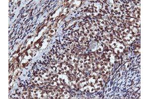 Image no. 2 for anti-V-Akt Murine Thymoma Viral Oncogene Homolog 1 (AKT1) antibody (ABIN1496557) (AKT1 Antikörper)