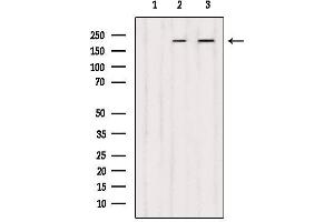 Western blot analysis of extracts from various samples, using DOCK1 Antibody. (DOCK1 Antikörper  (C-Term))