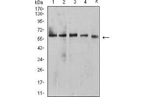 Western blot analysis using BTN1A1 mouse mAb against HepG2 (1), MCF-7 (2), SK-BR-3 (3), NIH/3T3 (4), and C6 (5) cell lysate. (BTN1A1 Antikörper  (AA 27-242))