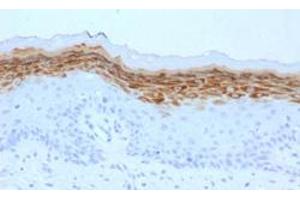 Immunohistochemical staining (Formalin-fixed paraffin-embedded sections) of human skin with FLG monoclonal antibody, clone FLG/1561 . (Filaggrin Antikörper  (AA 998-1104))