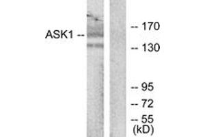 Western blot analysis of extracts from RAW264. (ASK1 Antikörper  (AA 932-981))