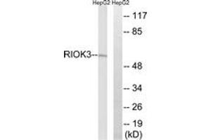 Western blot analysis of extracts from HepG2 cells, using RIOK3 Antibody. (RIOK3 Antikörper  (AA 271-320))
