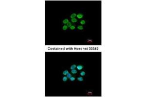 ICC/IF Image Immunofluorescence analysis of paraformaldehyde-fixed A431, using KAP1, antibody at 1:200 dilution. (KAP1 Antikörper)