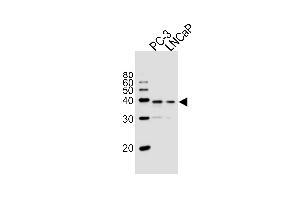 Western blot analysis of lysates from PC-3, LNCaP cell line (from left to right), using VDR Antibody at 1:1000 at each lane. (VD (AA 274-299) Antikörper)