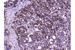 IHC analysis of CIC using anti-CIC antibody (ABIN6719536).