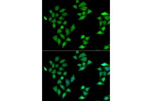 Immunofluorescence analysis of HeLa cell using ITLN1 antibody. (ITLN1/Omentin Antikörper)