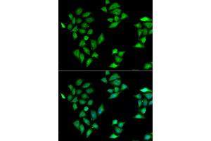 Immunofluorescence analysis of HeLa cell using ITLN1 antibody.