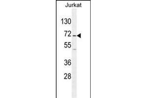 GAD2 Antibody (Center) (ABIN655070 and ABIN2844700) western blot analysis in Jurkat cell line lysates (35 μg/lane).