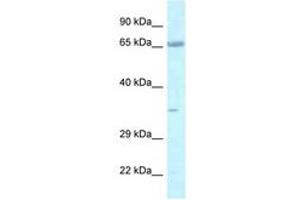 Image no. 1 for anti-Leucine Zipper, Putative Tumor Suppressor 1 (LZTS1) (AA 530-579) antibody (ABIN6747423) (LZTS1 Antikörper  (AA 530-579))