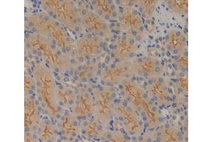 Used in DAB staining on fromalin fixed paraffin- embedded kidney tissue (FPGS Antikörper  (AA 210-439))