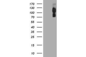 HEK293T cells were transfected with the pCMV6-ENTRY control (Left lane) or pCMV6-ENTRY ENPEP (Right lane) cDNA for 48 hrs and lysed. (ENPEP Antikörper)