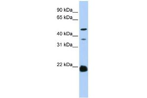 WB Suggested Anti-ZDHHC14 Antibody Titration:  0. (ZDHHC14 Antikörper  (N-Term))