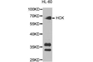 Western blot analysis of extracts of HL-60 cell lines, using HCK antibody. (HCK Antikörper  (AA 1-220))