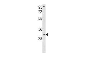 Western blot analysis of SOD3 Antibody (N-term) (ABIN390857 and ABIN2841079) in K562 cell line lysates (35 μg/lane). (SOD3 Antikörper  (N-Term))