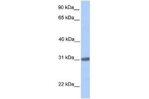 WB Suggested Anti-C7orf61 Antibody Titration: 0. (C7orf61 Antikörper  (C-Term))