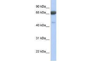 PNMA3 antibody used at 1 ug/ml to detect target protein. (PNMA3 Antikörper  (Middle Region))
