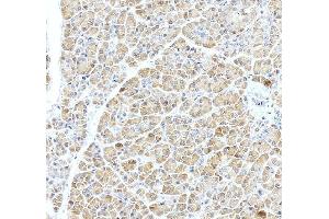 anti-ADP-Ribosylation Factor GTPase Activating Protein 1 (ARFGAP1) (AA 1-183) antibody