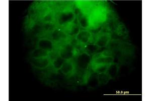Immunofluorescence (IF) image for anti-Mevalonate (Diphospho) Decarboxylase (MVD) (AA 301-398) antibody (ABIN561884)