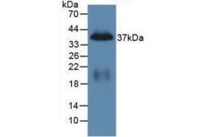 Western blot analysis of recombinant Mouse PP. (PPY Antikörper  (AA 31-97))