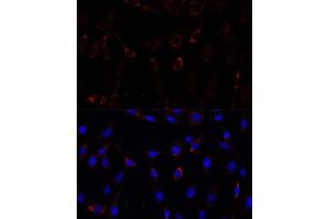 Immunofluorescence analysis of C6 cells using RNF112 antibody (ABIN7270054) at dilution of 1:100. (RNF112 Antikörper  (AA 200-500))