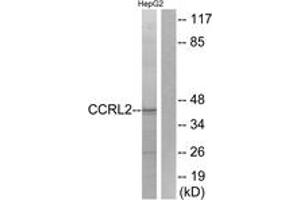 Western blot analysis of extracts from HepG2 cells, using CCRL2 Antibody. (CCRL2 Antikörper  (AA 141-190))