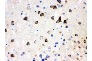 Anti- SSH3BP1 Picoband antibody, IHC(P) IHC(P): Mouse Brain Tissue (ABI1 Antikörper  (N-Term))