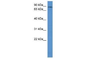 WB Suggested Anti-ADD3 Antibody Titration: 0. (ADD3 Antikörper  (C-Term))