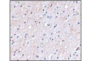 Immunohistochemical staining of human brain tissue using AP30596PU-N at 2. (NIPSNAP1 Antikörper  (C-Term))