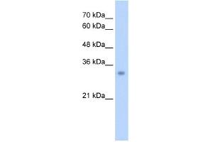 WB Suggested Anti-ECH1 Antibody Titration:  2. (ECH1 Antikörper  (N-Term))