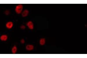 ABIN6274294 staining Hela cells by IF/ICC. (ELL Antikörper  (Internal Region))