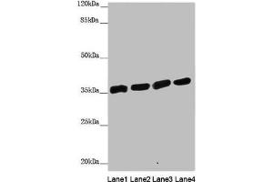 Western blot All lanes: ANKRD1 antibody at 1. (ANKRD1 Antikörper  (AA 1-130))