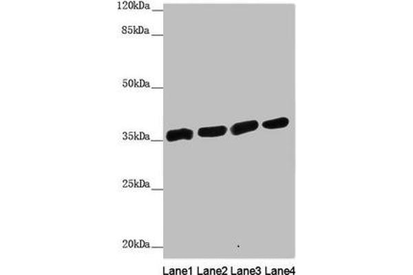 ANKRD1 anticorps  (AA 1-130)