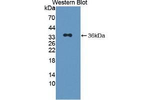 Western blot analysis of the recombinant protein. (Pirin Antikörper  (AA 1-290))