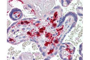Anti-F13A1 / Factor XIIIa antibody IHC of human placenta. (F13A1 Antikörper)