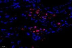 Immunofluorescent analysis of paraformaldehyde-fixed human lung using,FLJ22167 (ABIN7073961) at dilution of 1: 1400 (FLJ22167 Antikörper)