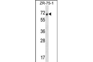RCOR1 Antibody (N-term) (ABIN1538927 and ABIN2848670) western blot analysis in ZR-75-1 cell line lysates (35 μg/lane). (CoREST Antikörper  (N-Term))