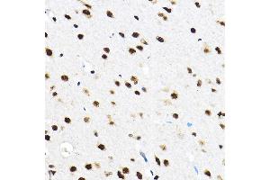 Immunohistochemistry (IHC) image for anti-Splicing Factor 3a, Subunit 3, 60kDa (SF3A3) (AA 292-501) antibody (ABIN1682671)