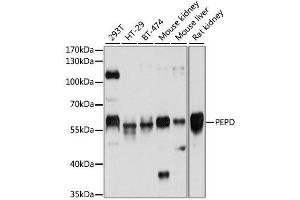 Western blot analysis of extracts of various cell lines, using PEPD antibody. (PEPD Antikörper  (AA 288-424))