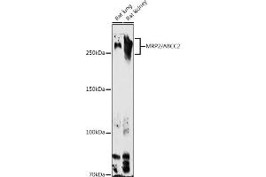 Western blot analysis of extracts of various cell lines, using MRP2/ antibody (ABIN6129853, ABIN6136357, ABIN6136358 and ABIN6224455) at 1:1000 dilution. (ABCC2 Antikörper  (AA 180-315))