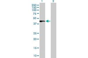 Western Blot analysis of IFNAR2 expression in transfected 293T cell line by IFNAR2 MaxPab polyclonal antibody. (IFNAR2 Antikörper  (AA 1-331))