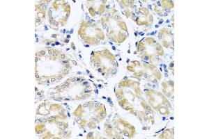 Immunohistochemistry of paraffin-embedded human stomach using NDUFB10 antibody (ABIN5972156) at dilution of 1/100 (40x lens). (NDUFB10 Antikörper)