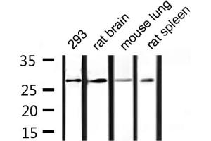 Western blot analysis of extracts from 293, rat brain, mouse lung, rat spleen, using 14-3-3 γ Antibody. (14-3-3 gamma Antikörper  (Internal Region))