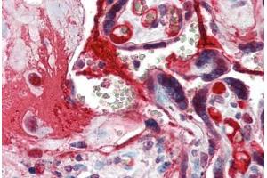 Anti-CCNE1 / Cyclin E1 antibody IHC of human placenta. (Cyclin E1 Antikörper  (C-Term))