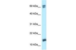 Image no. 1 for anti-Nudix (Nucleoside Diphosphate Linked Moiety X)-Type Motif 2 (NUDT2) (AA 53-102) antibody (ABIN6747897)