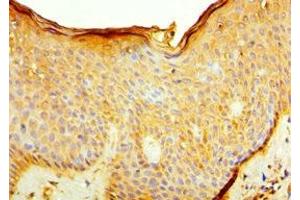 Immunohistochemistry of paraffin-embedded human skin tissue using ABIN7156926 at dilution of 1:100 (IL7R Antikörper  (AA 21-239))