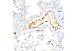 Immunohistochemistry of paraffin-embedded Mouse lung using von Willebrand factor (VWF) antibody (ABIN7271339) at dilution of 1:800 (40x lens). (VWF Antikörper)